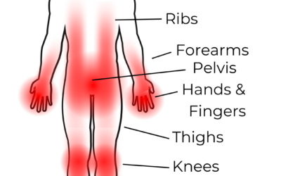 Tattoo Pain Chart: The Most and Least Painful Spots for Your Next Ink